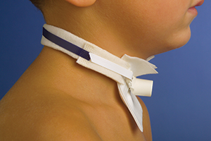 501 p Trach Tie 501 p Trach Tie