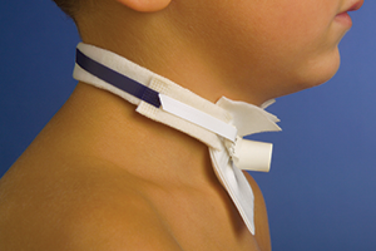 501 p Trach Tie